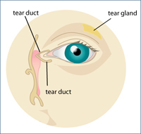 Dry Eye Chart