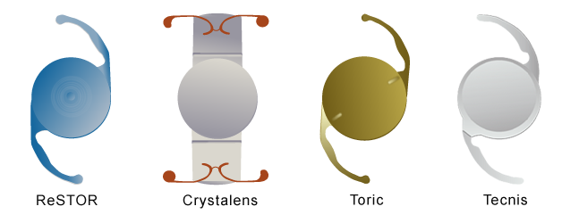 Four Types of IOLs